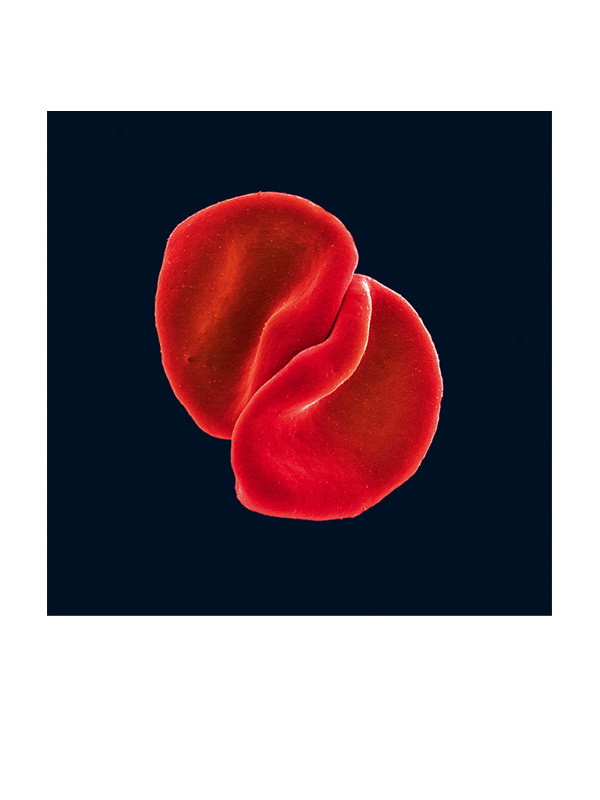 Peter Gabriel, Scratch My Back Album Cover, 2010